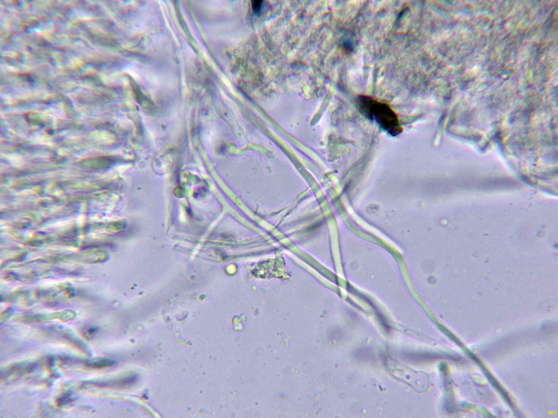 10 - Hifas subhimeniales  Melzer-001